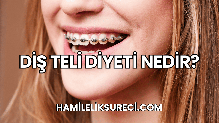 Diş Teli Diyeti Nedir?