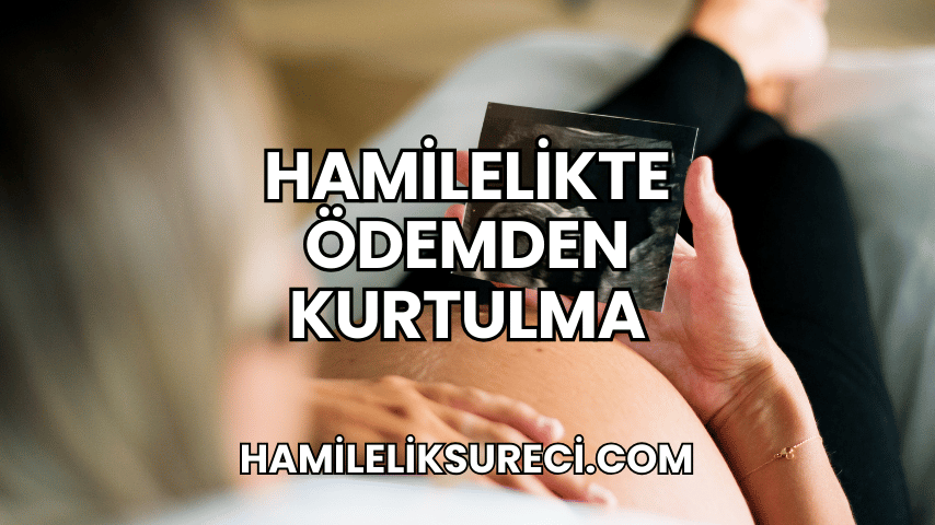 Hamilelikte Ödemden Kurtulma 