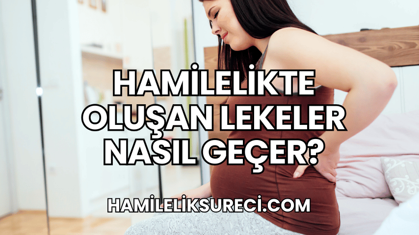 Hamilelikte Oluşan Lekeler Nasıl Geçer?