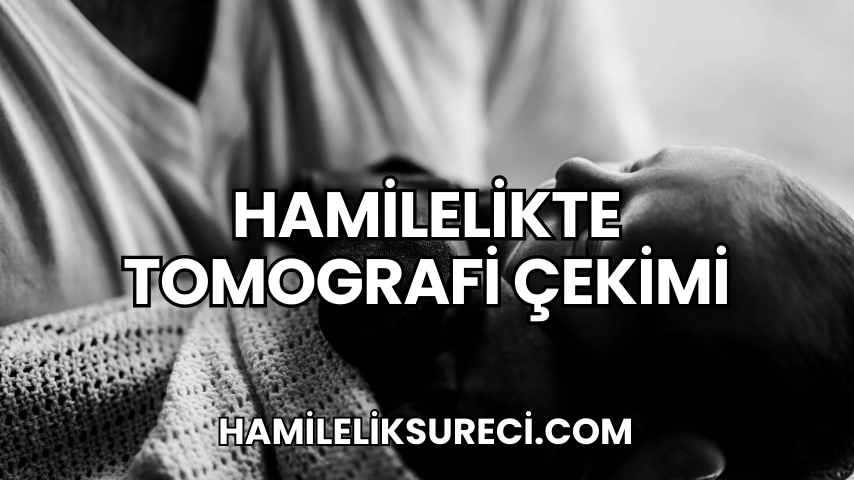 Hamilelikte Tomografi Çekimi