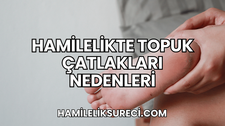 Hamilelikte Topuk Çatlakları Nedenleri