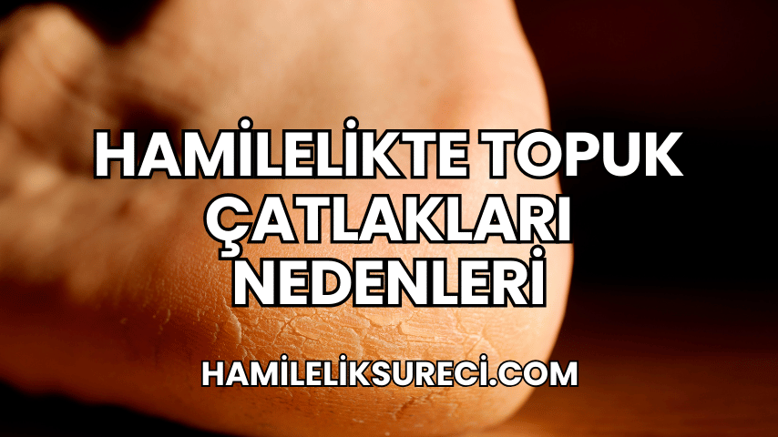 Hamilelikte Topuk Çatlakları Nedenleri