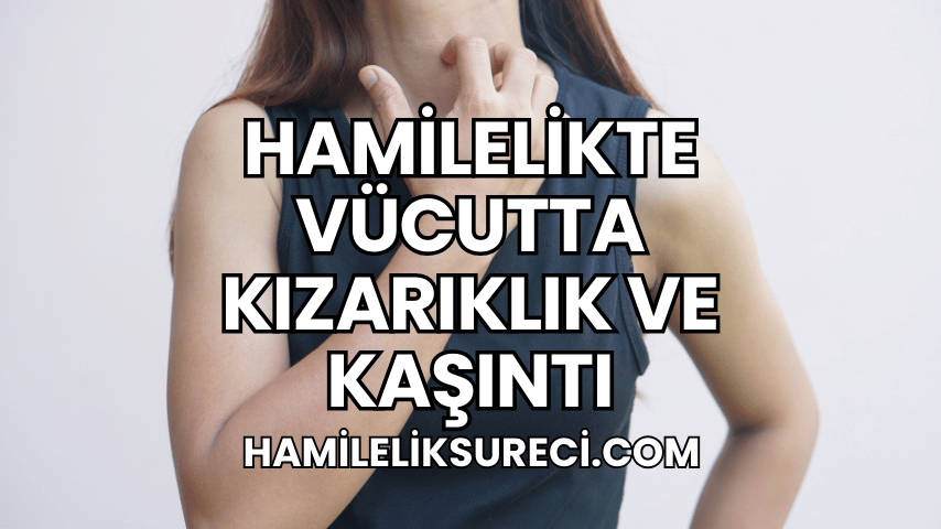 Hamilelikte Vücutta Kızarıklık ve Kaşıntı