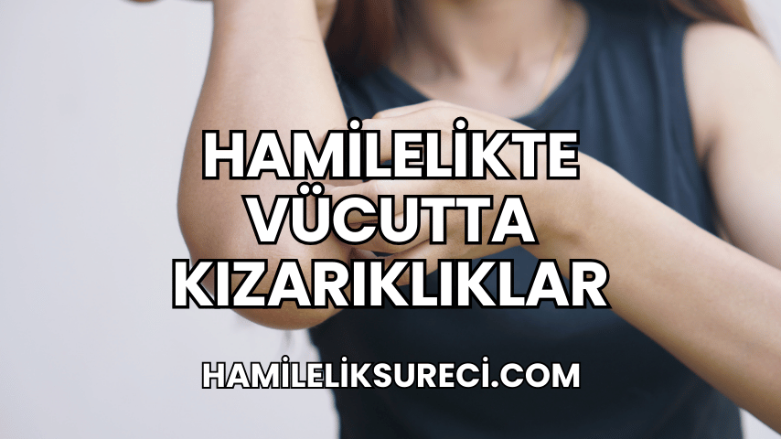 Hamilelikte Vücutta Kızarıklıklar