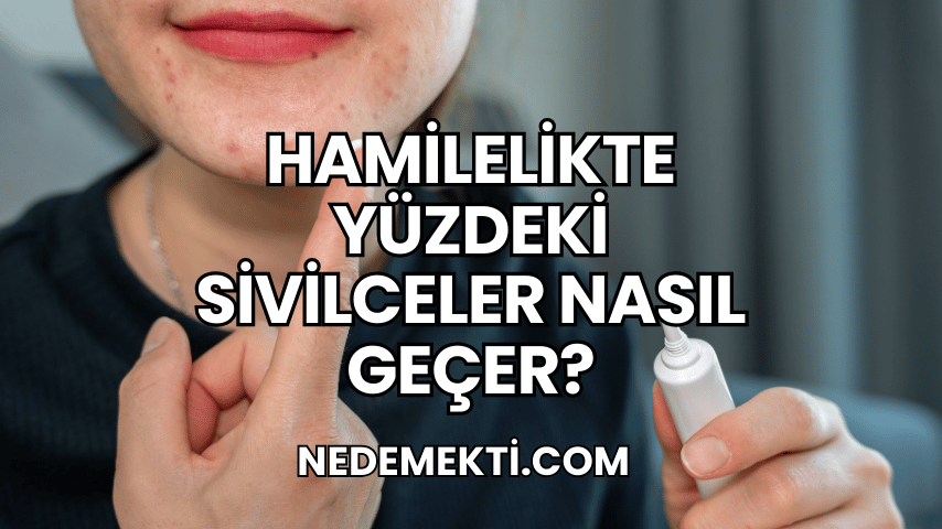 Hamilelikte Yüzdeki Sivilceler Nasıl Geçer?