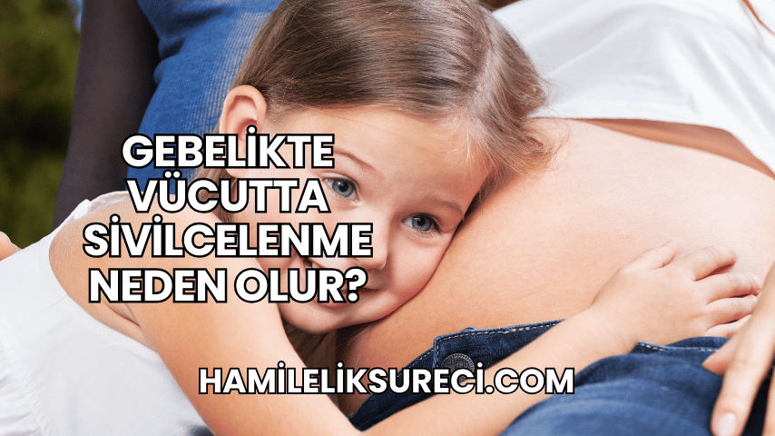 Gebelikte Vücutta Sivilcelenme Neden Olur?